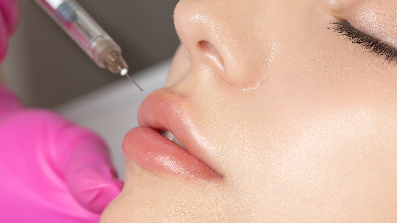 Princess Lip Filler What You Should Know About The Procedure (& How