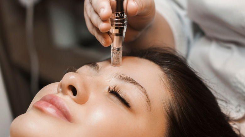 microneedling procedure