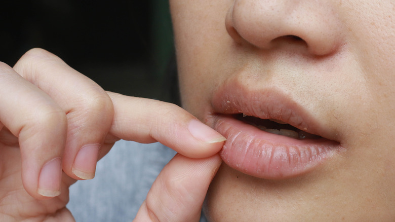 Person picking at their chapped lips.