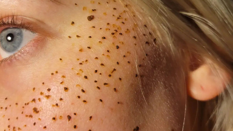 Henna freckles