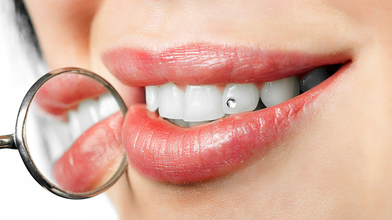 woman sporting new tooth gem with mirror