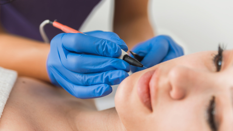 woman getting electrolysis on face