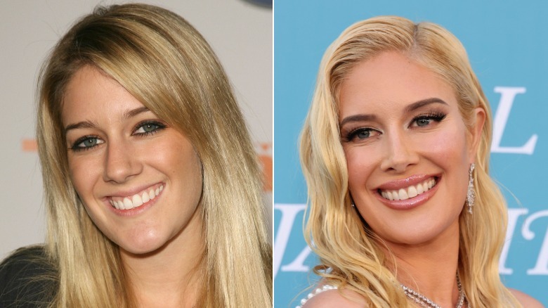 Heidi Montag in 2006 and 2025