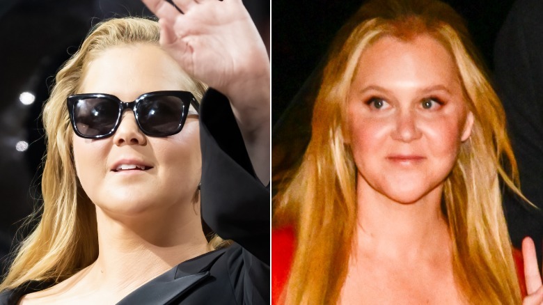 Amy Schumer in 2022 and 2025