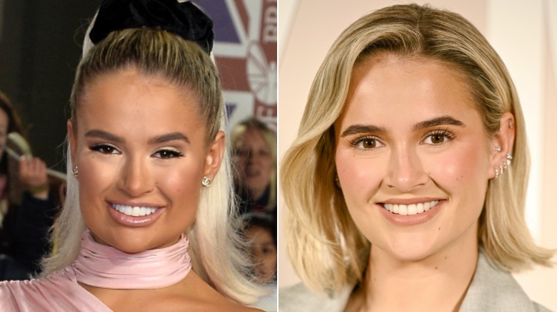 A side-by-side comparison photo showing Molly-Mae Hague with and without fillers